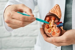 Kidney Cancer Prevention